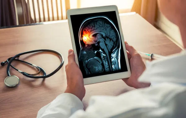 Foto de un medico que mira en una tablet una resonancia de un cerebro