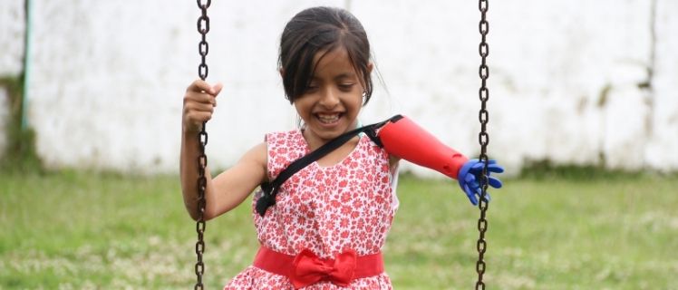 Foto de una niña que sonrie en un columpio y con una protesis del brazo
