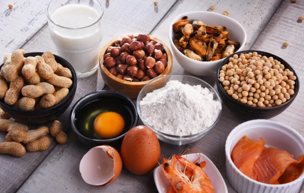 Foto de varios productos posibles de alergias alimentarias