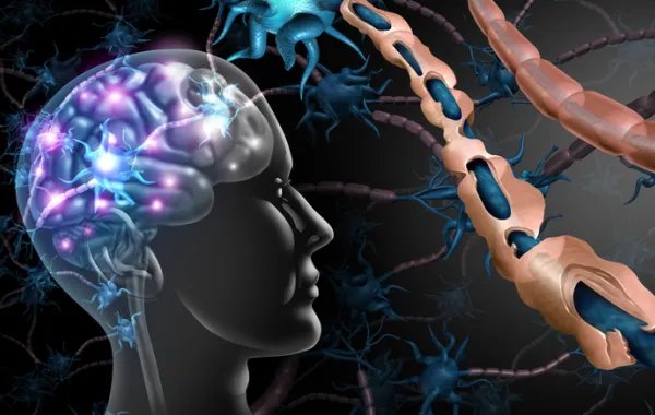 Foto de un dibujo en 3 dimensiones de un cerebro y sus partes