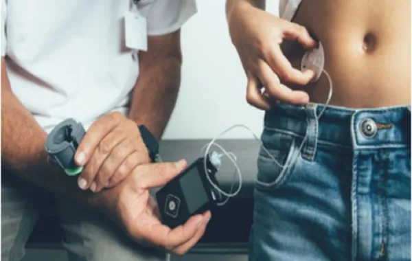 Foto de una persona con un aparato de bomba de insulina