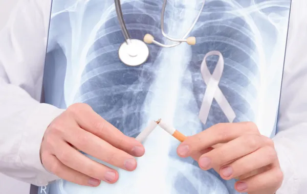 Foto con una radiografía de pulmones, y unos manos que rompen un cigarrillo