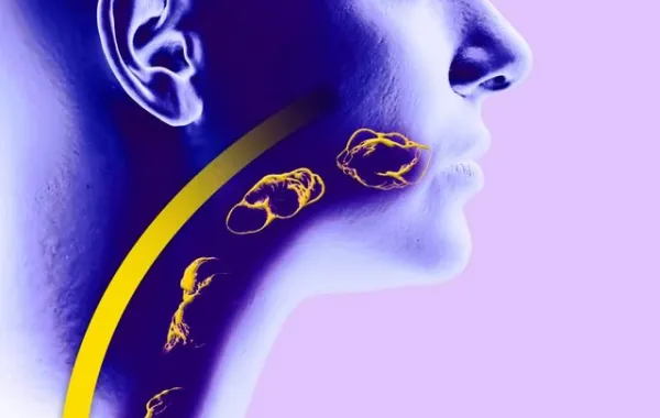 Imagen representativa de la Disfagia