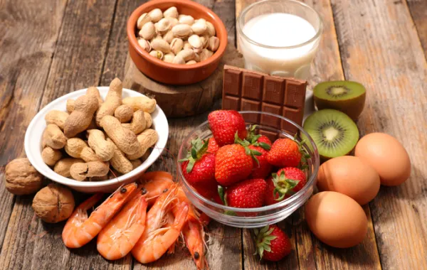 Foto de una mesa llena de varias de todos los productos alimentaciones