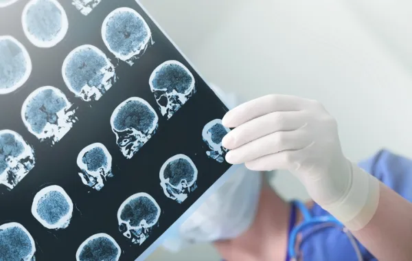 Foto de una radiografía